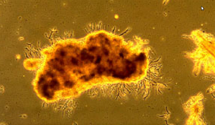 Micrografia de um floco bacteriano em um sistema de Lodo Ativado. As regiões escuras indicam altas concentrações de bactérias no interior do floco.(Fonte: The Biological Basis of Wastewater Treatment)